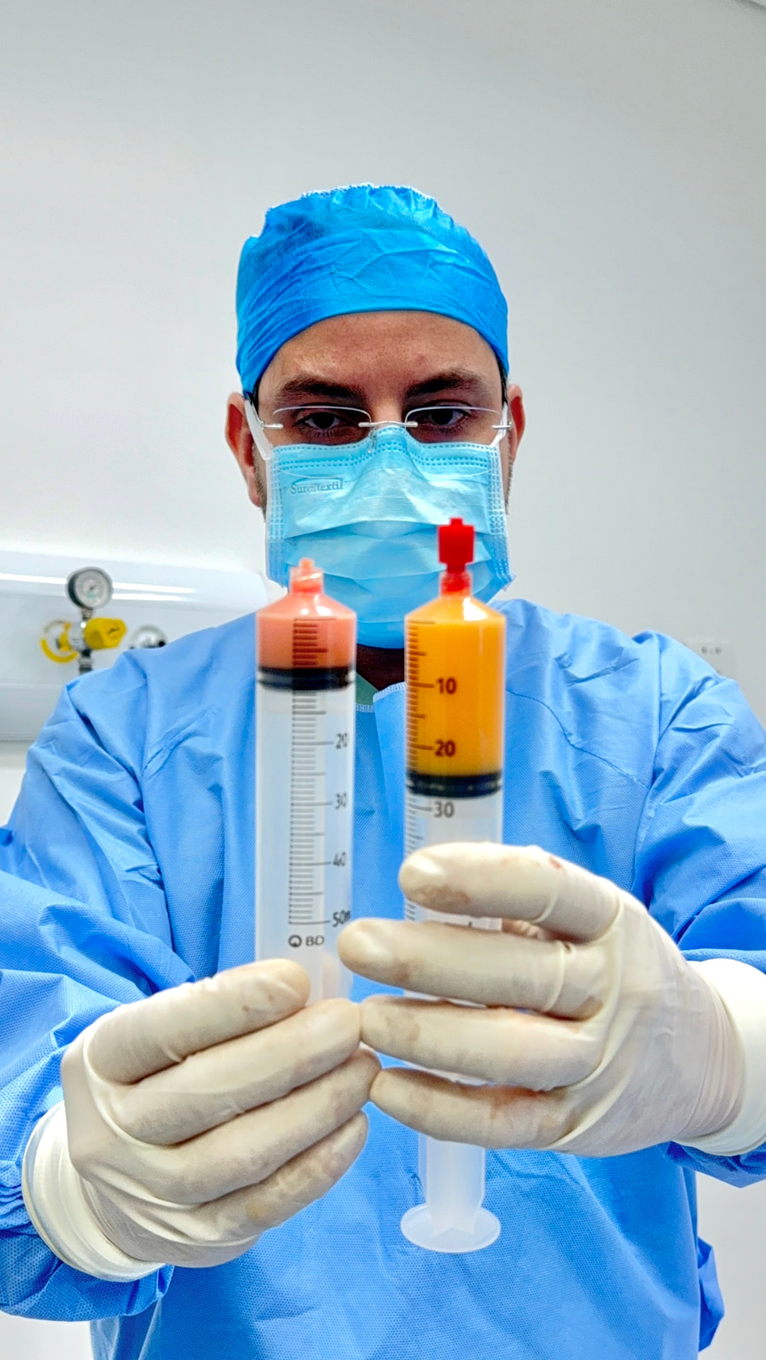 Dr. Alexei Gama segurando seringas com gordura processada